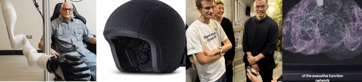 Advancements in Brain Chips | neurosock🧠Brain Chips🦾